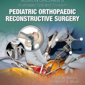 Boston Children's Illustrated Tips and Tricks in Pediatric Orthopaedic Reconstructive Surgery-ISBN: 9781975103880
