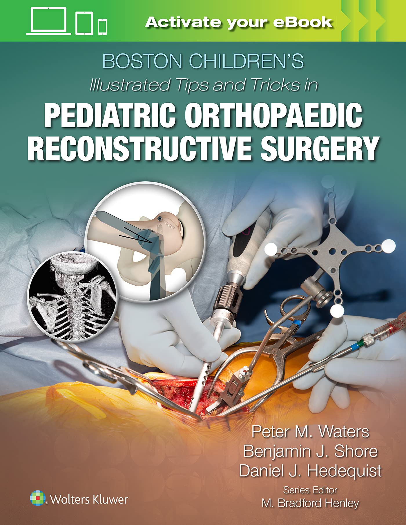 Boston Children's Illustrated Tips and Tricks in Pediatric Orthopaedic Reconstructive Surgery-ISBN: 9781975103880