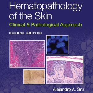 Hematopathology of the Skin: Clinical & Pathological Approach-ISBN: 9781975158552