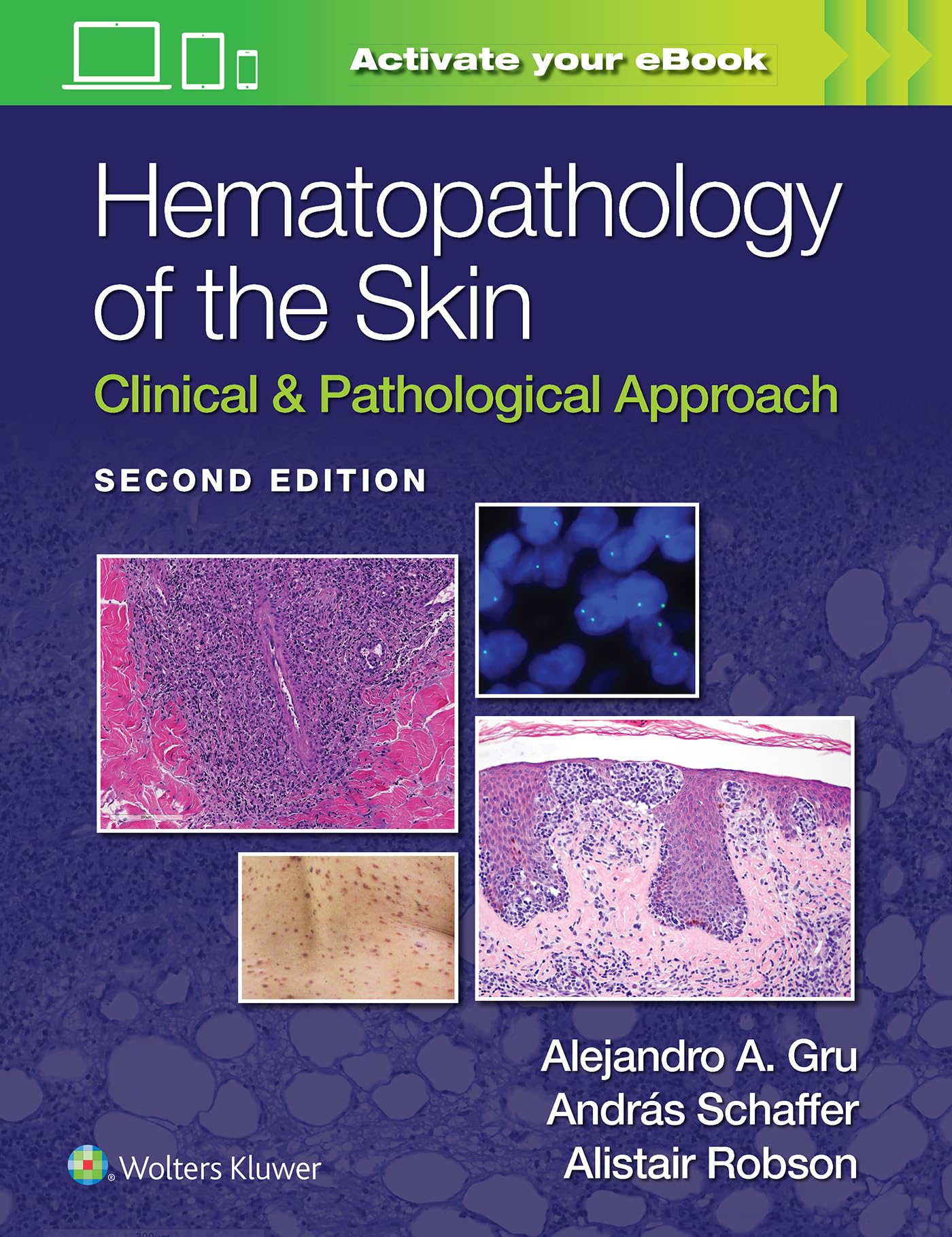 Hematopathology of the Skin: Clinical & Pathological Approach-ISBN: 9781975158552