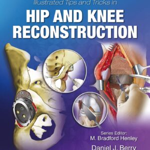 Illustrated Tips and Tricks in Hip and Knee Reconstructive and Replacement Surgery-ISBN: 9781496392060