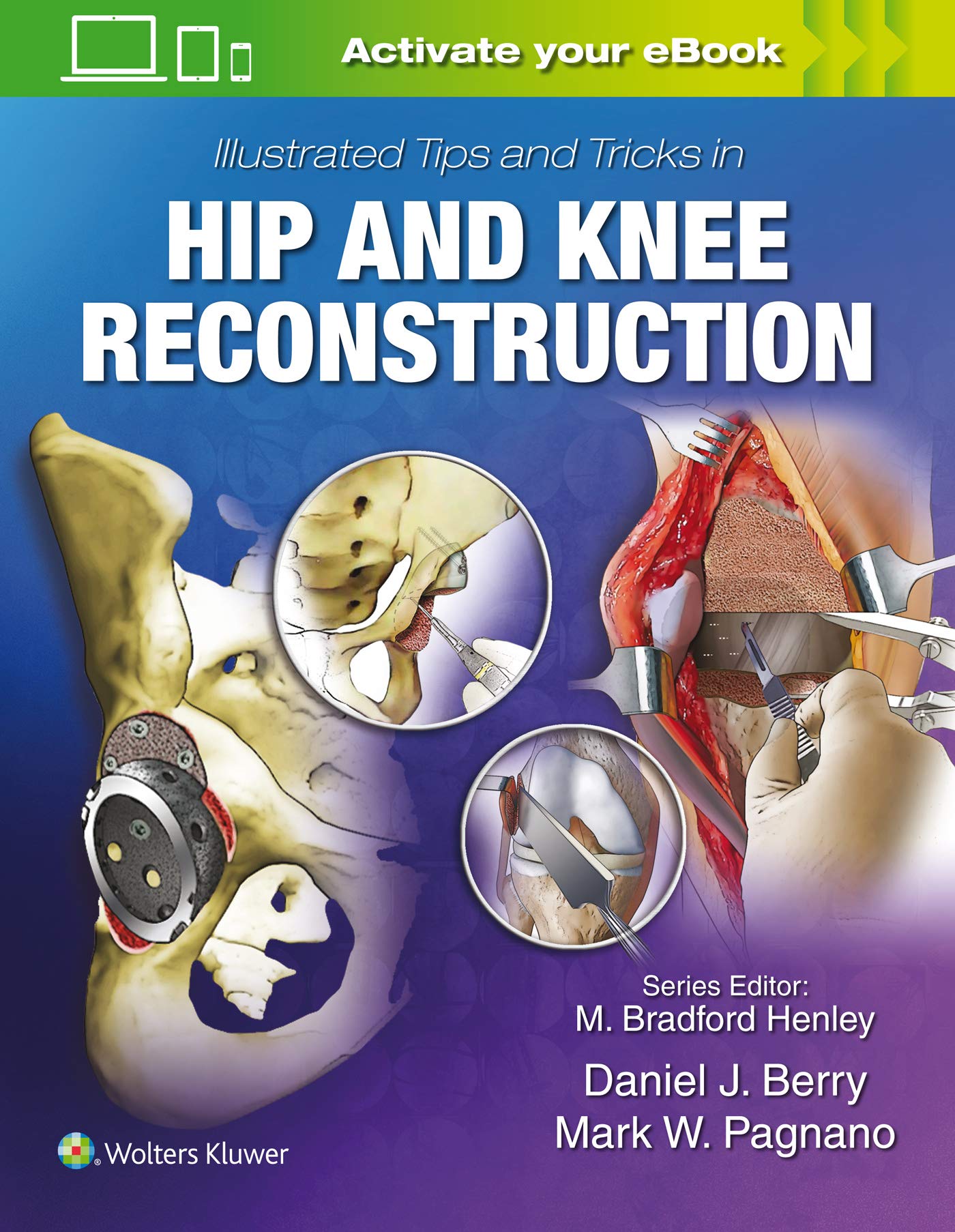 Illustrated Tips and Tricks in Hip and Knee Reconstructive and Replacement Surgery-ISBN: 9781496392060