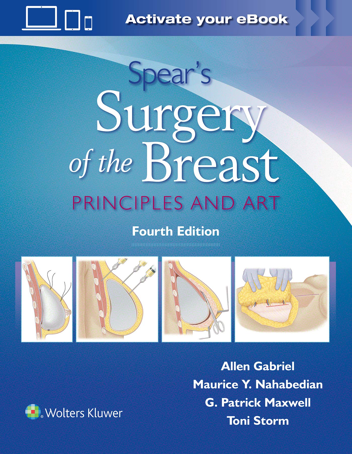Spear's Surgery of the Breast: Principles and Art-ISBN: 9781496397010