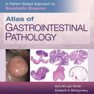 Atlas of Gastrointestinal Pathology: A Pattern Based Approach to Neoplastic Biopsies-ISBN: 9781496367549