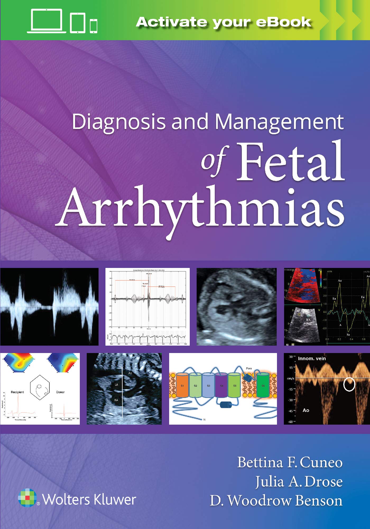 Diagnosis and Management of Fetal Arrhythmias-ISBN: 9781975122867