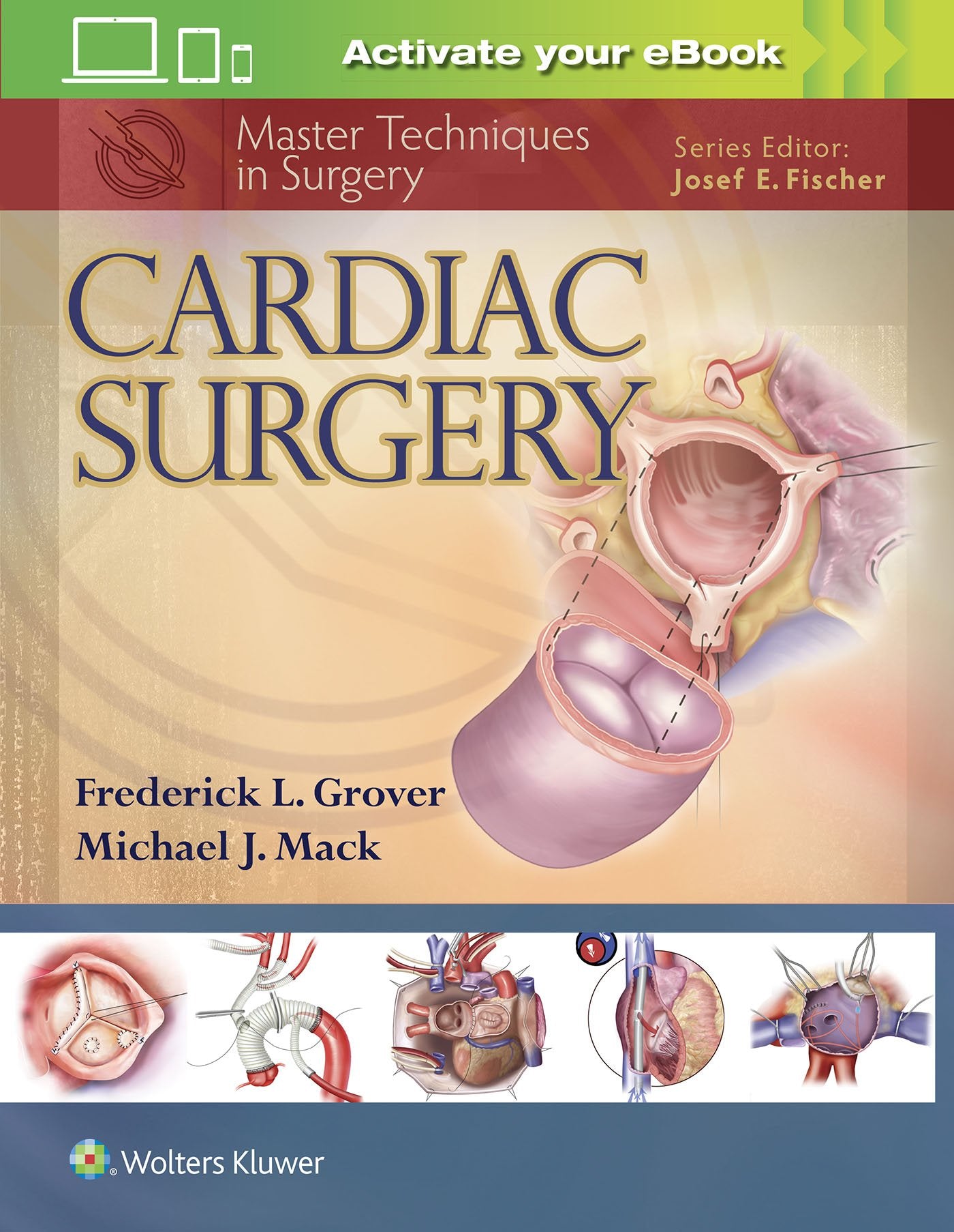 Cardiac Surgery (Master Techniques in Surgery)-ISBN: 9781451193534