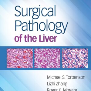 Surgical Pathology of the Liver-ISBN: 9781496365798