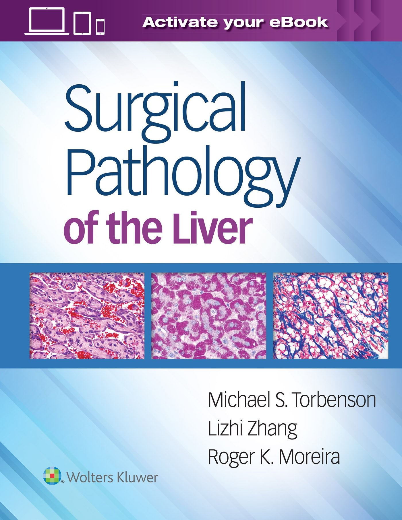 Surgical Pathology of the Liver-ISBN: 9781496365798