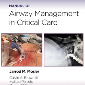 Manual of Airway Management in Critical Care: Print + eBook with Multimedia-ISBN: 9781975214203