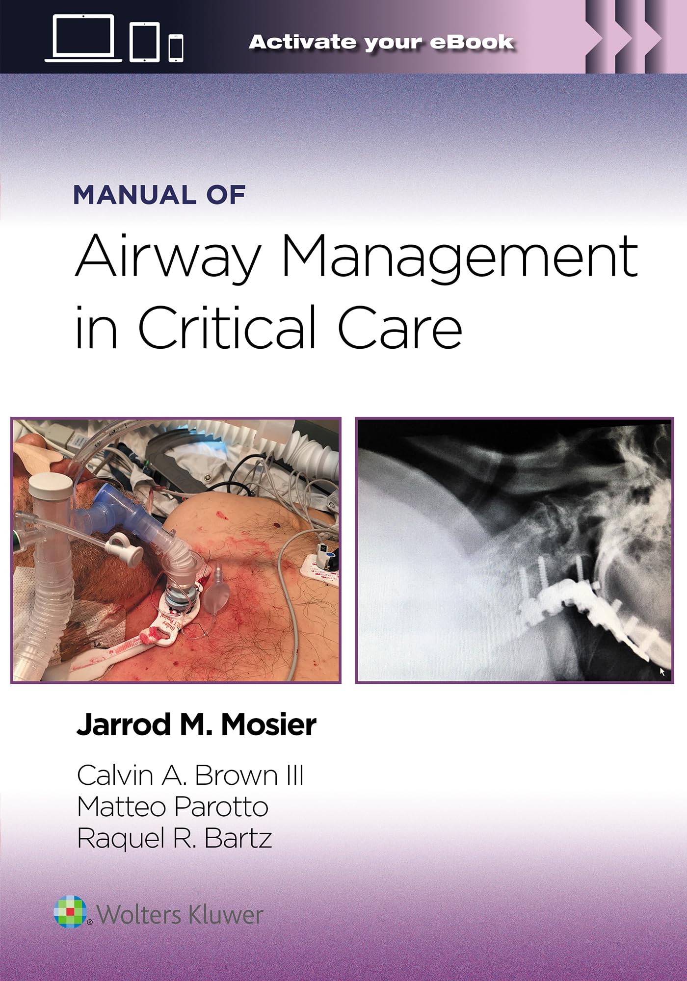 Manual of Airway Management in Critical Care: Print + eBook with Multimedia-ISBN: 9781975214203