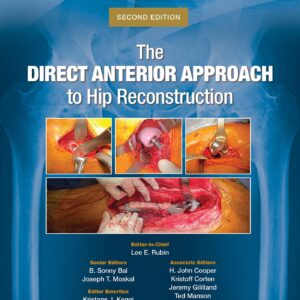 The Direct Anterior Approach to Hip Reconstruction-ISBN: 9781975221973
