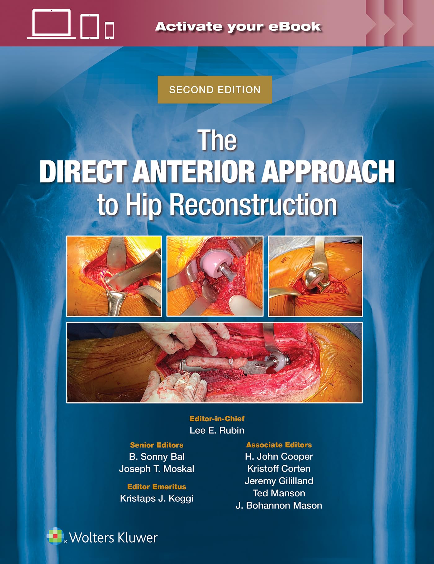 The Direct Anterior Approach to Hip Reconstruction-ISBN: 9781975221973