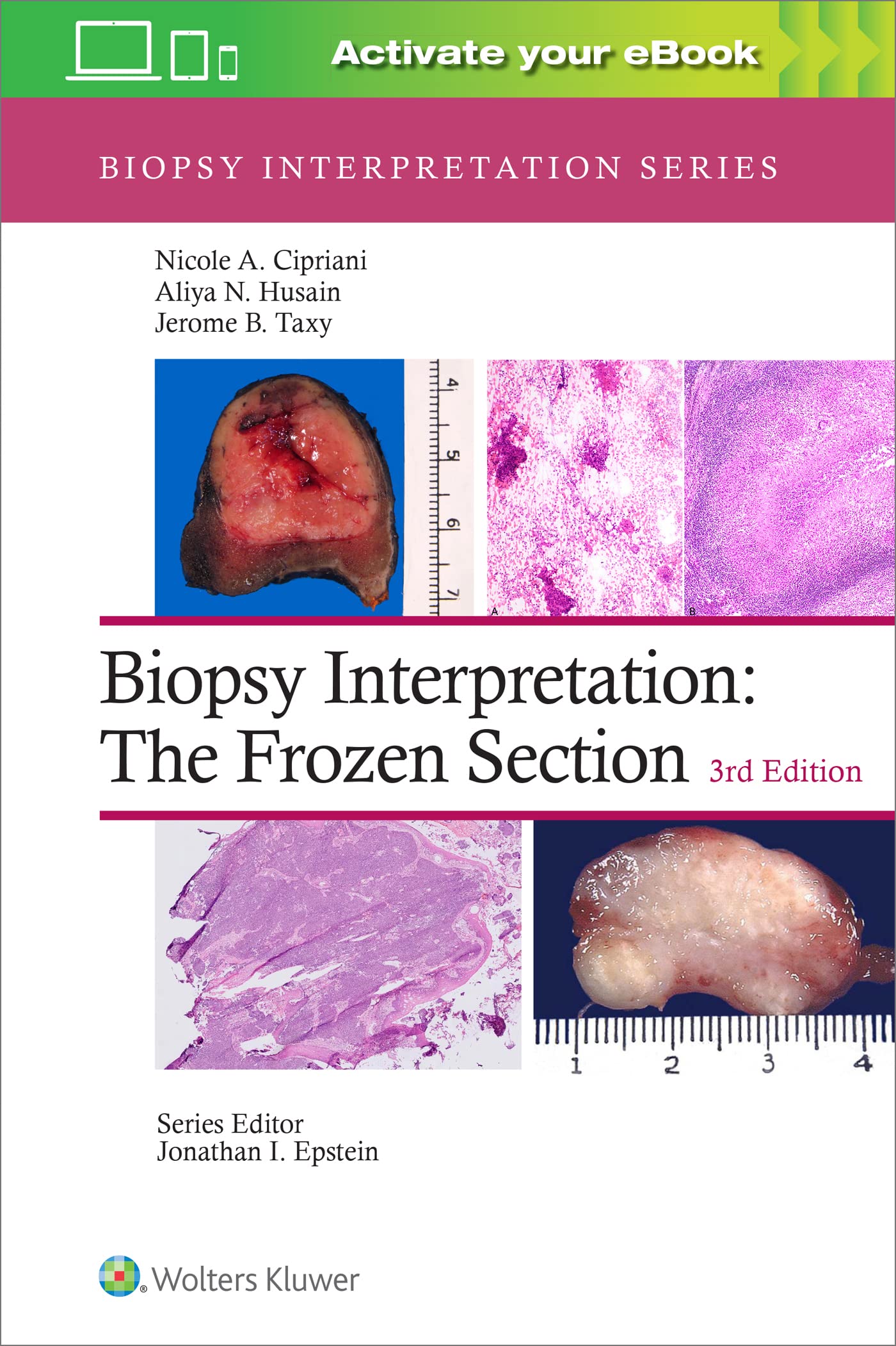 Biopsy Interpretation: The Frozen Section: Print + eBook with Multimedia-ISBN: 9781975170073