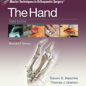 Master Techniques in Orthopaedic Surgery: The Hand-ISBN: 9781451182781
