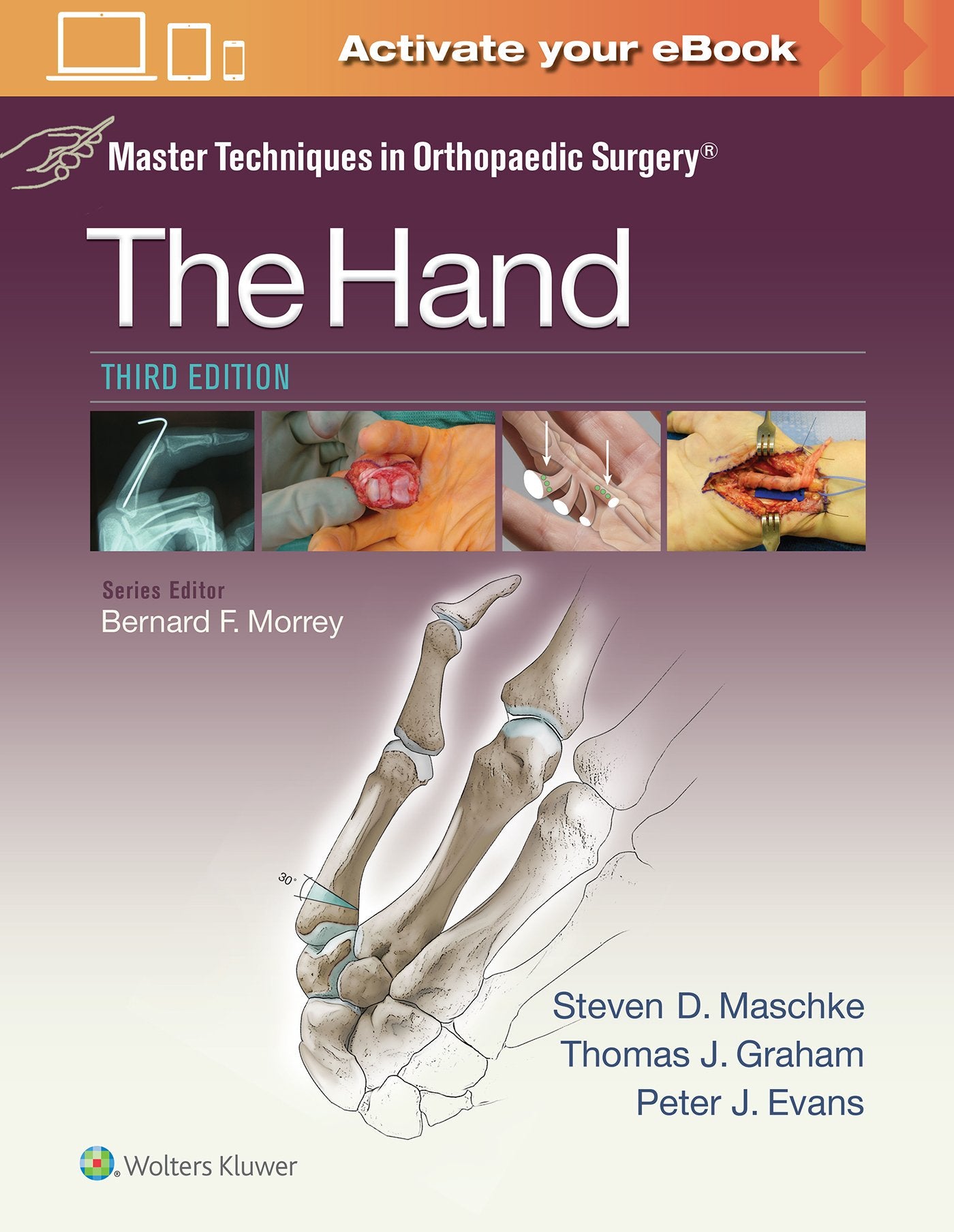 Master Techniques in Orthopaedic Surgery: The Hand-ISBN: 9781451182781