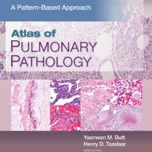 Atlas of Pulmonary Pathology: A Pattern Based Approach-ISBN: 9781496397553