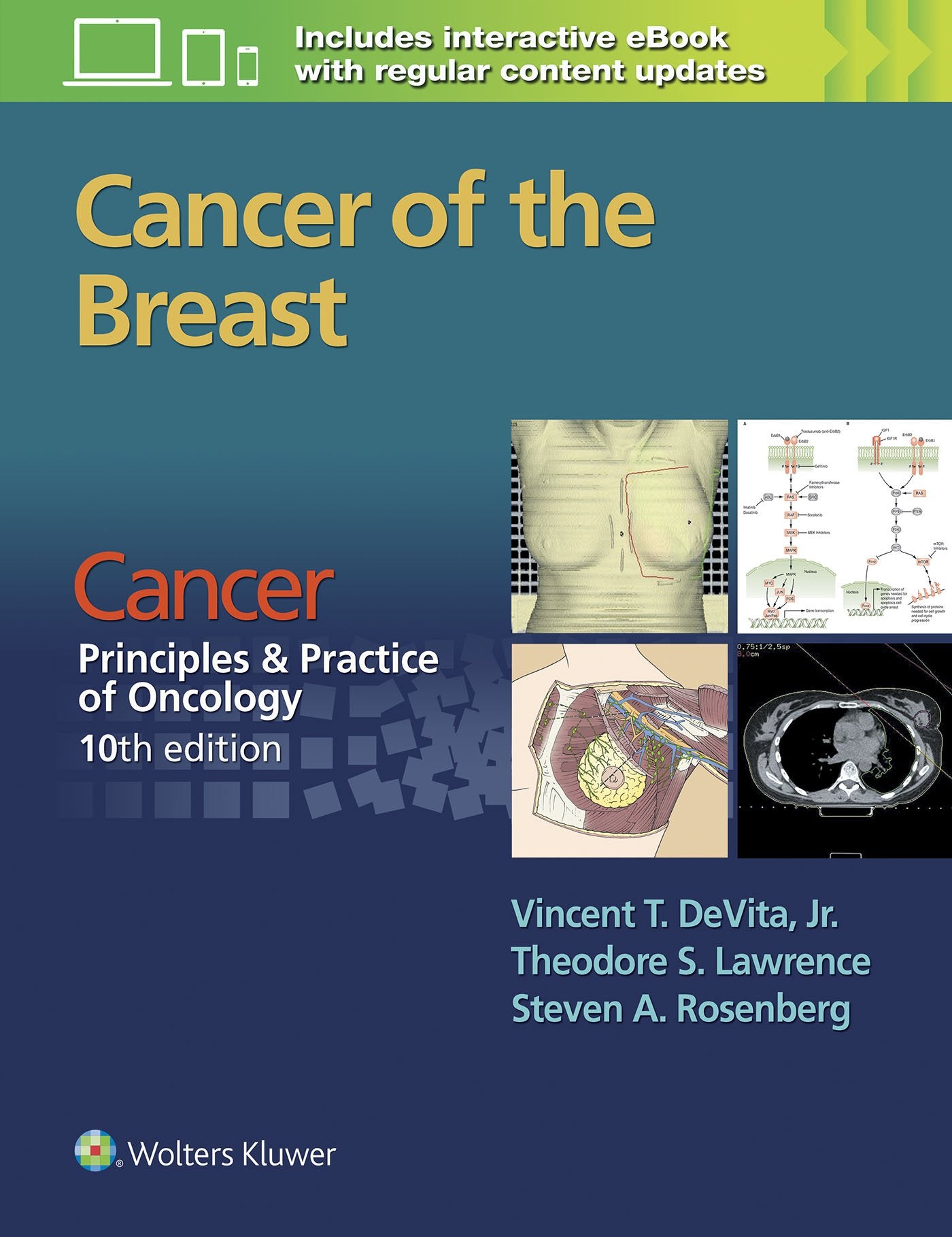 Cancer: Principles & Practice of Oncology. Cancer of the Breast-ISBN: 9781496333988