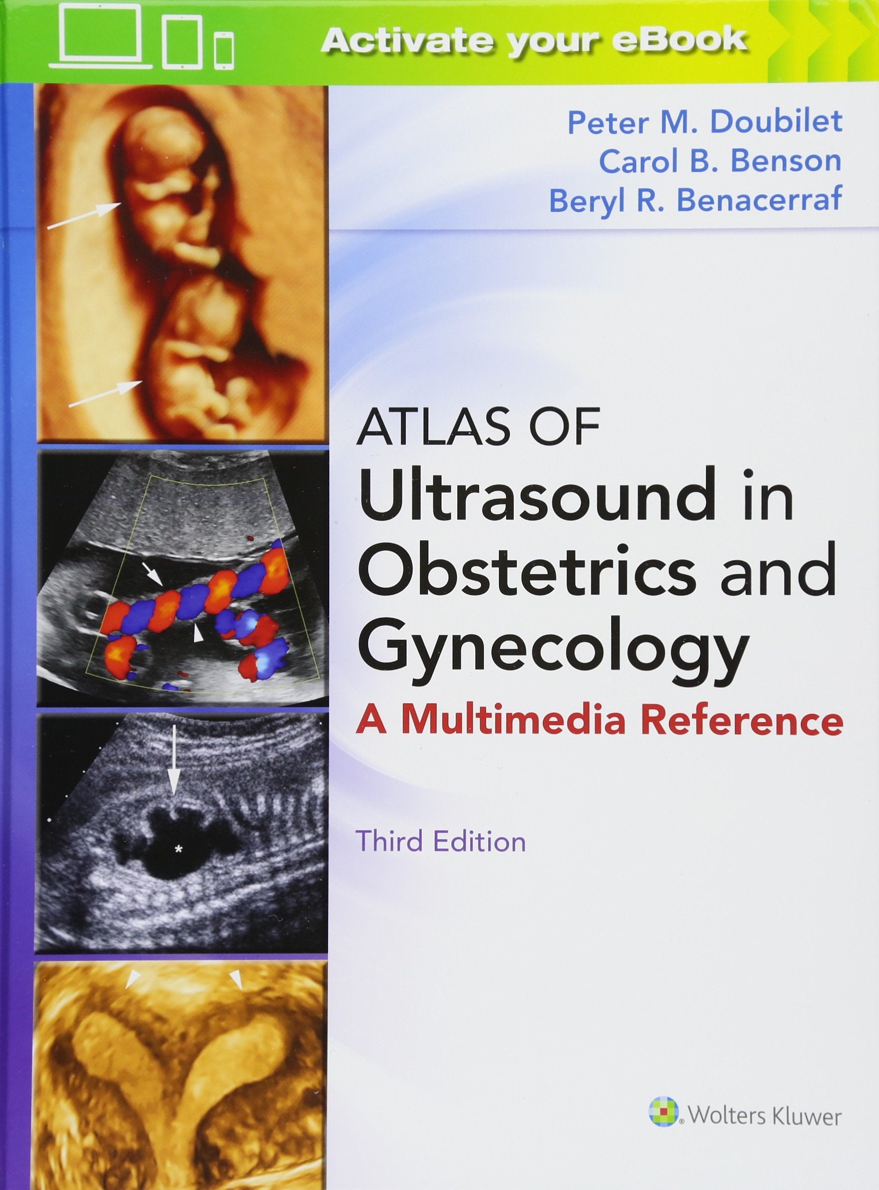 Atlas of Ultrasound in Obstetrics and Gynecology-ISBN: 9781496356055
