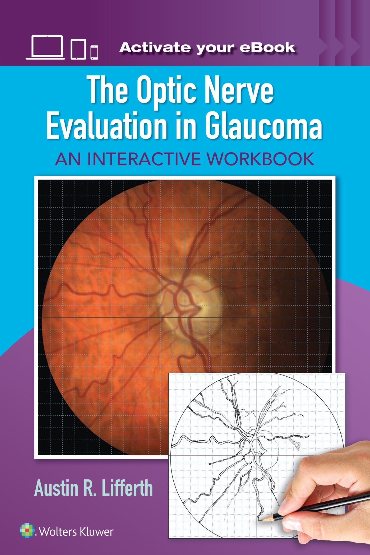 The Optic Nerve Evaluation in Glaucoma: An Interactive Workbook-ISBN: 9781496363138
