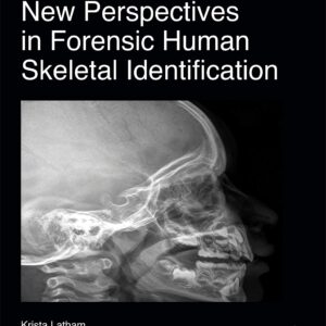 New Perspectives in Forensic Human Skeletal Identification