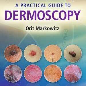 A Practical Guide to Dermoscopy-ISBN: 9781451192636