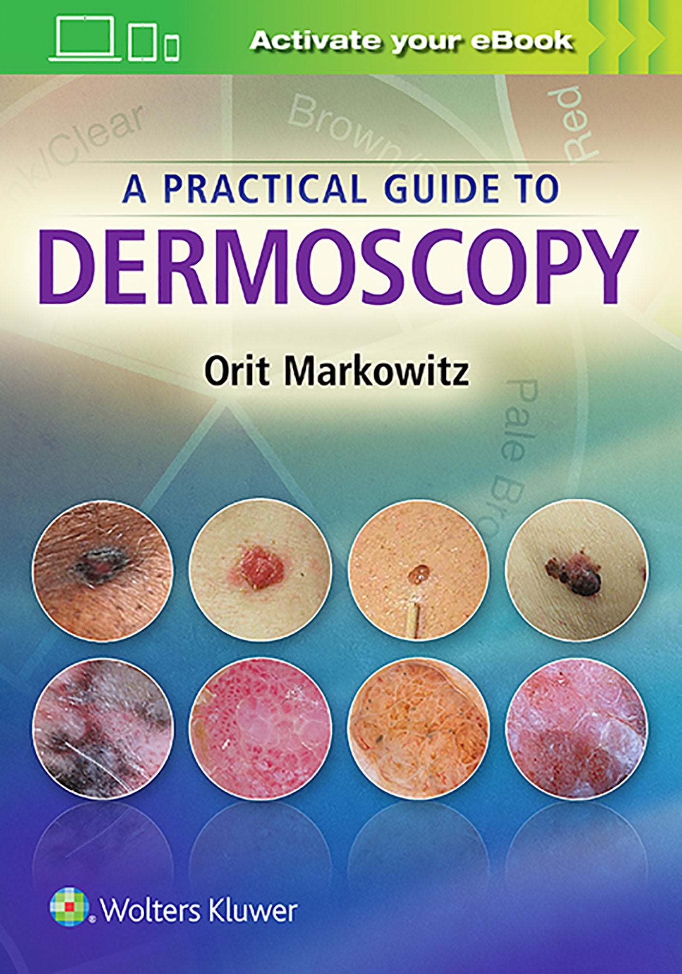 A Practical Guide to Dermoscopy-ISBN: 9781451192636