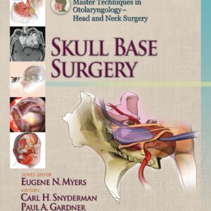 Master Techniques in Otolaryngology - Head and Neck Surgery: Skull Base Surgery-ISBN: 9781451173628