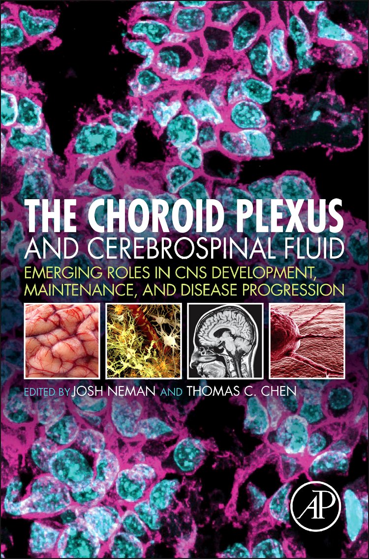 The Choroid Plexus and Cerebrospinal Fluid: Emerging Roles in CNS Development