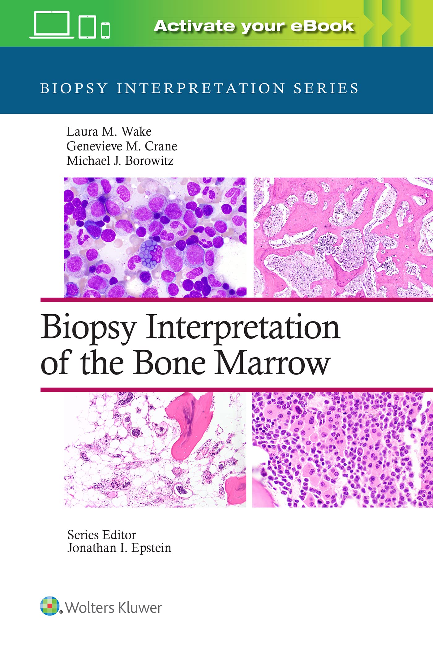 Biopsy Interpretation of the Bone Marrow: Print + eBook with Multimedia-ISBN: 9781496300591