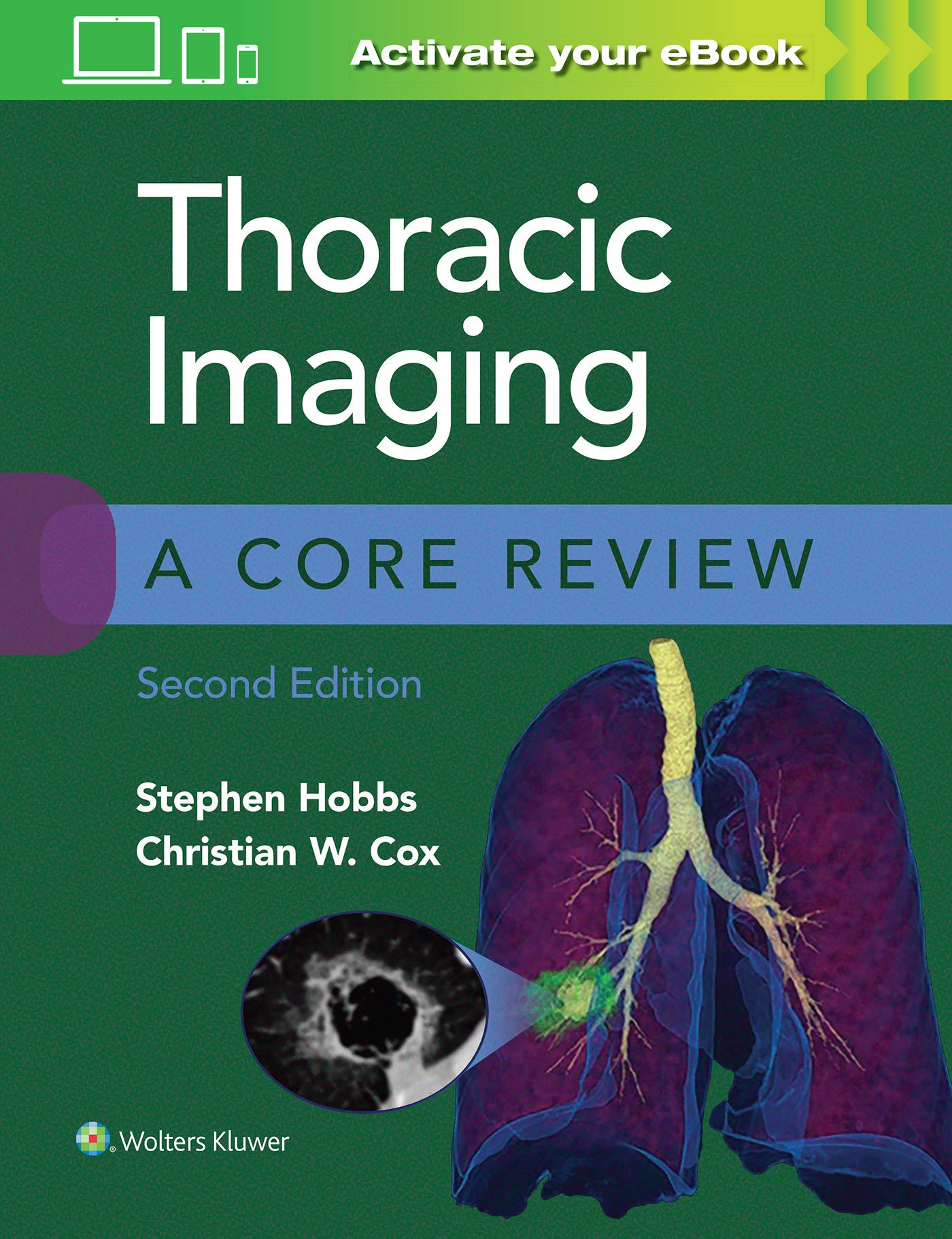 Thoracic Imaging: A Core Review-ISBN: 9781975126223