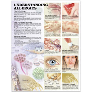 Understanding Allergies Anatomical Chart-ISBN: 9781587799402