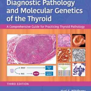Diagnostic Pathology and Molecular Genetics of the Thyroid: A Comprehensive Guide for Practicing Thyroid Pathology-ISBN: 9781496396532