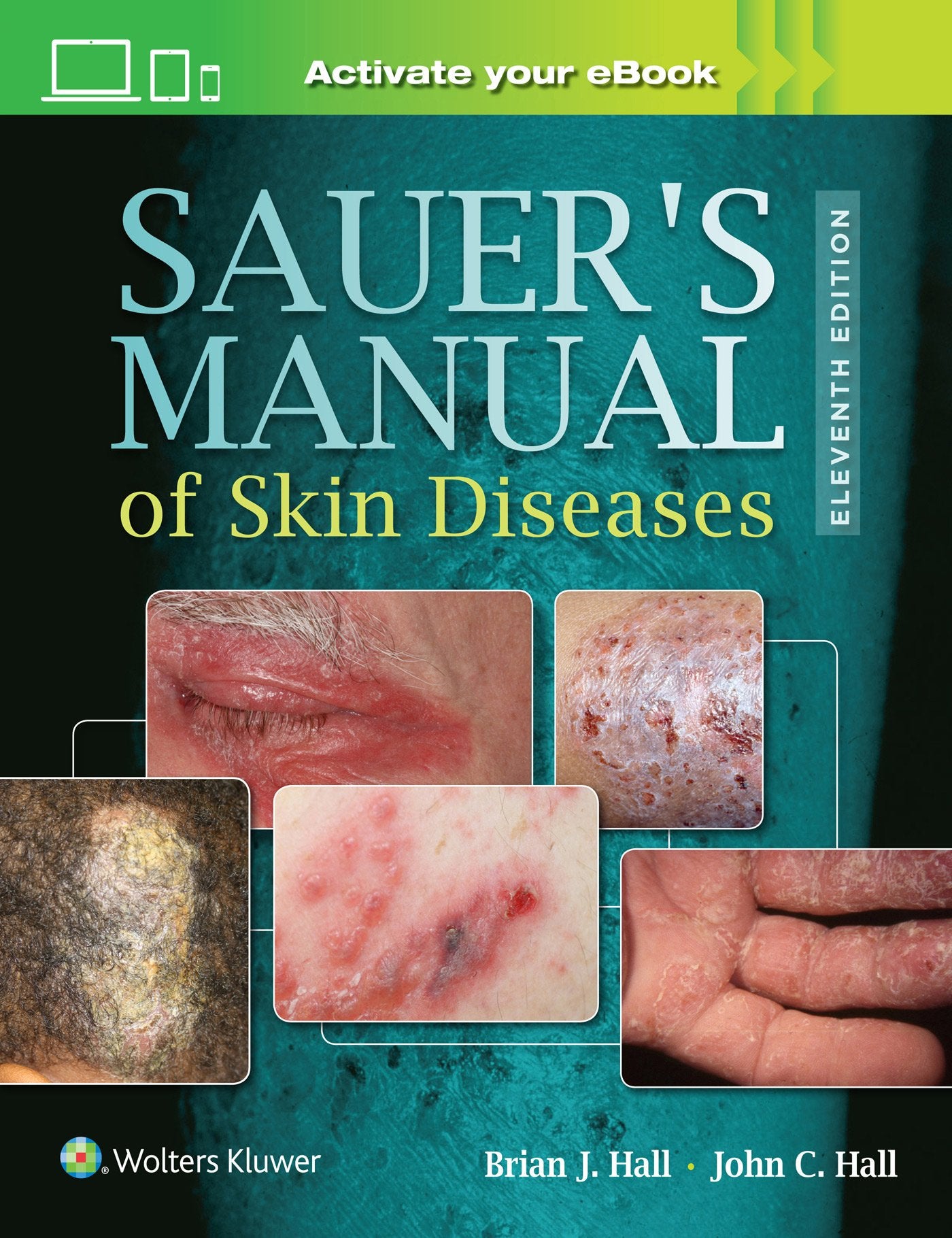 Sauer's Manual of Skin Diseases-ISBN: 9781496329936