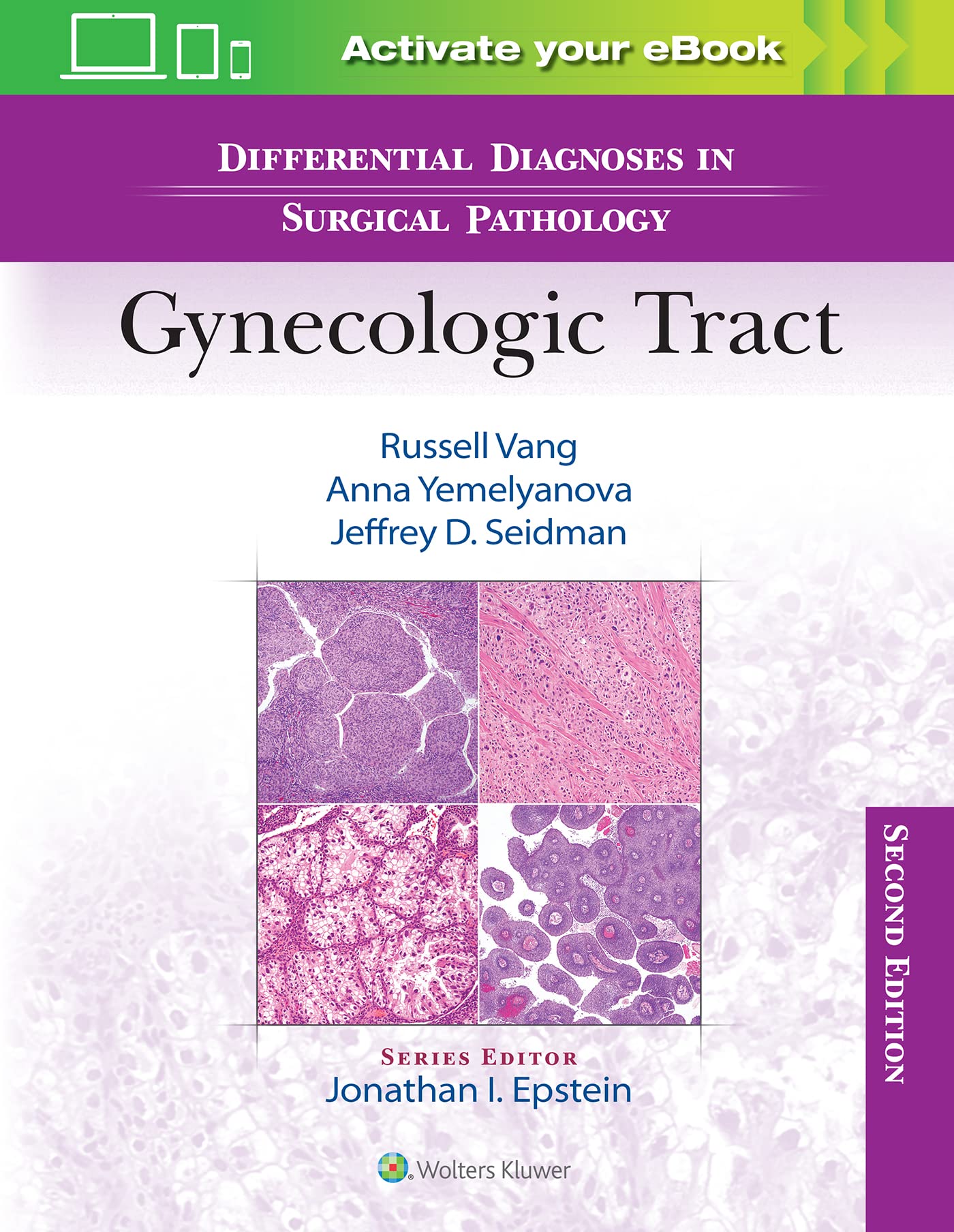 Differential Diagnoses in Surgical Pathology: Gynecologic Tract-ISBN: 9781975199012