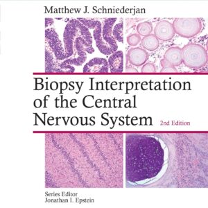 Biopsy Interpretation of the Central Nervous System-ISBN: 9781496382634