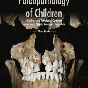 Paleopathology of Children: Identification of Pathological Conditions in the Human Skeletal Remains of Non-Adults