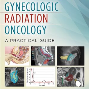 Gynecologic Radiation Oncology: A Practical Guide-ISBN: 9781451192650