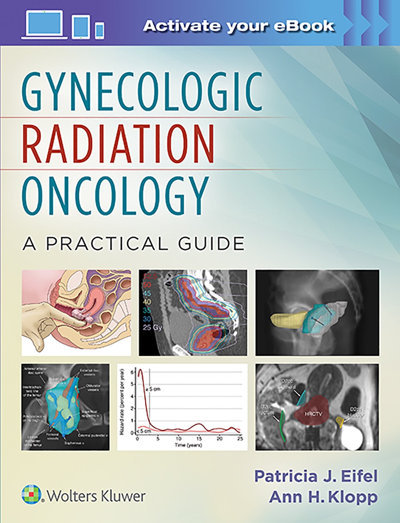 Gynecologic Radiation Oncology: A Practical Guide-ISBN: 9781451192650