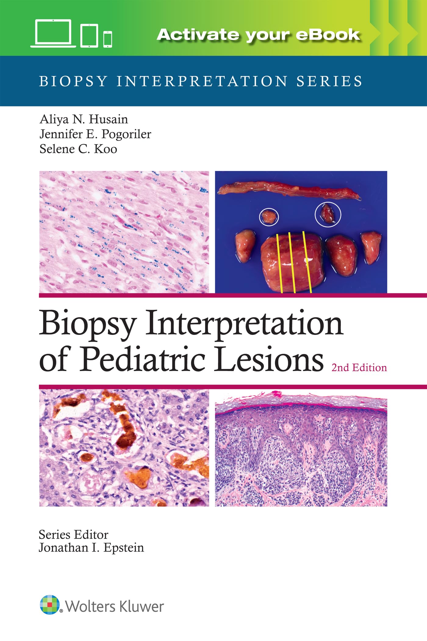 Biopsy Interpretation of Pediatric Lesions: Print + eBook with Multimedia (Biopsy Interpretation Series)-ISBN: 9781975213268
