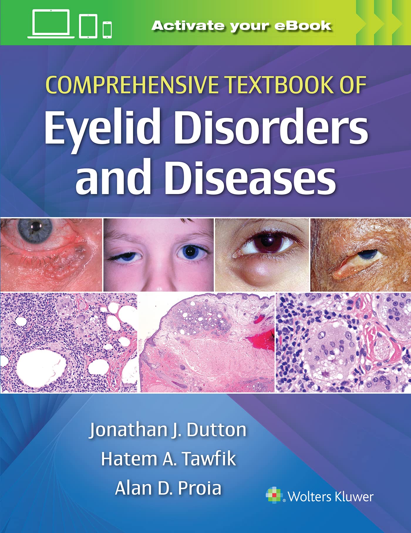 Comprehensive Textbook of Eyelid Disorders and Diseases-ISBN: 9781975146146