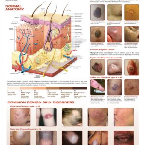 Common Lesions and Disorders of the Skin Anatomical Chart-ISBN: 9781975191016
