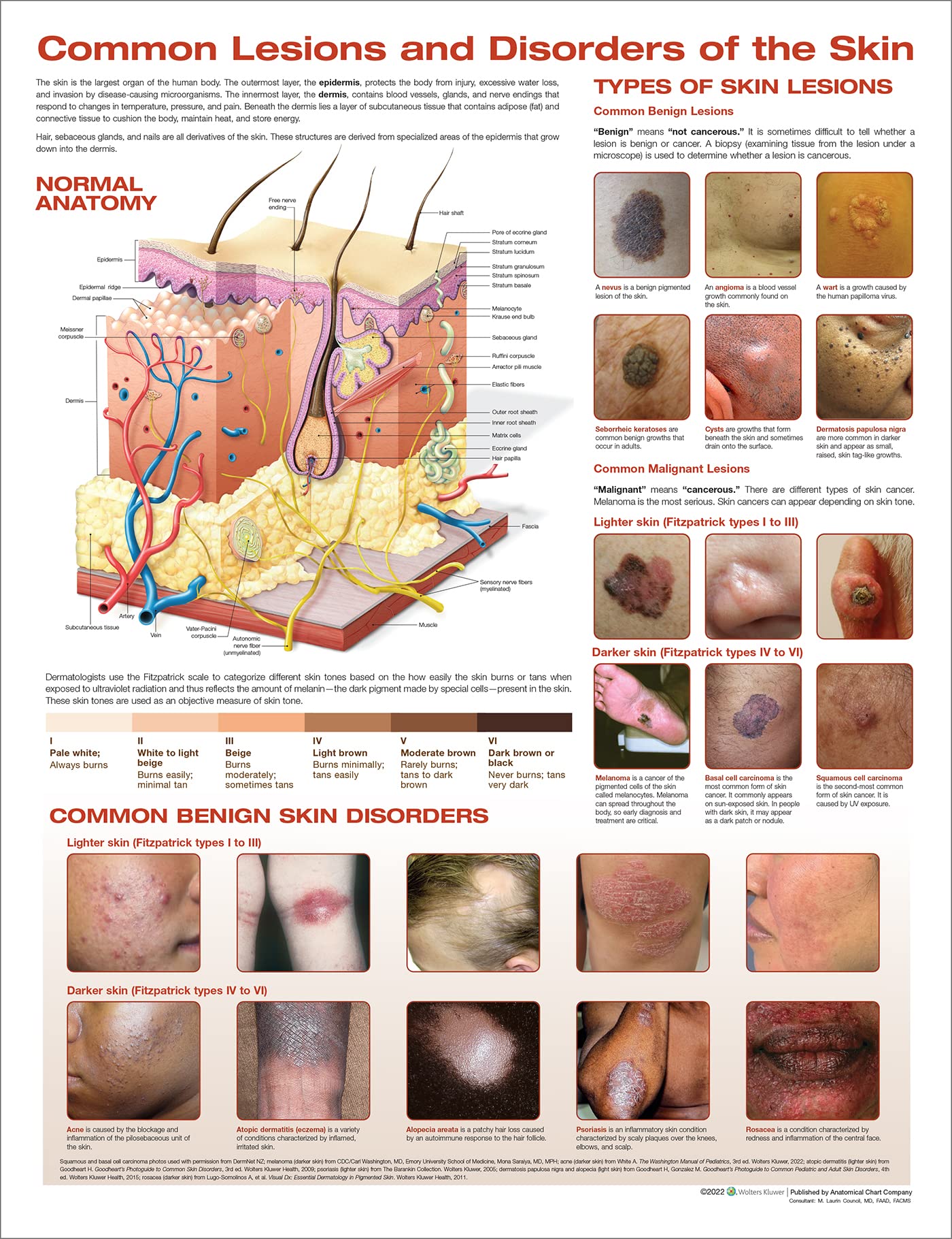 Common Lesions and Disorders of the Skin Anatomical Chart-ISBN: 9781975191016