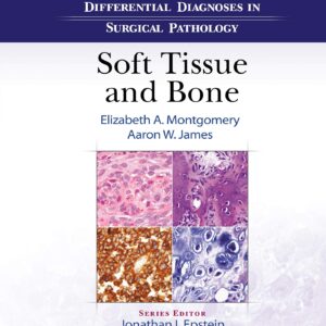 Differential Diagnoses in Surgical Pathology: Soft Tissue and Bone-ISBN: 9781975136024
