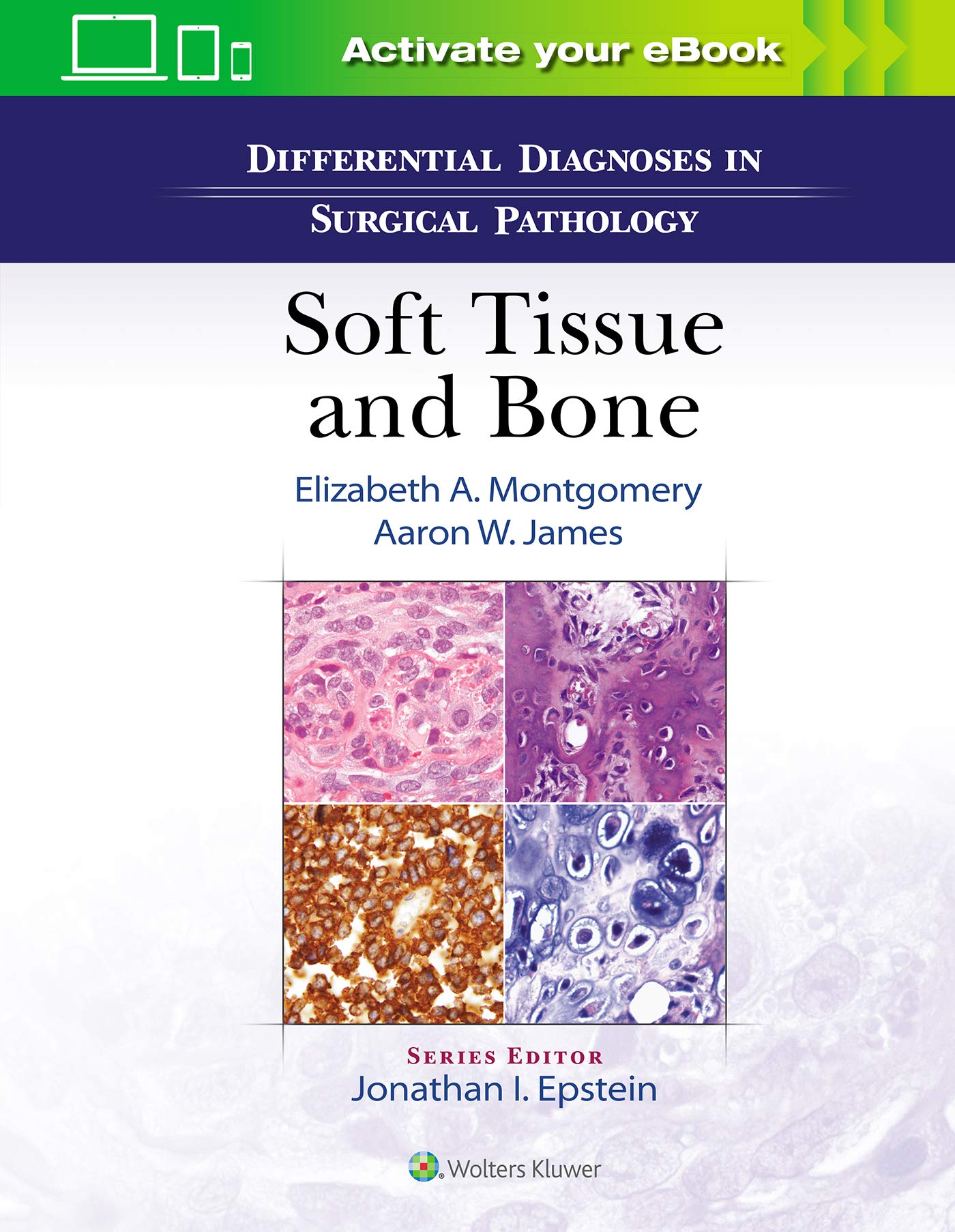 Differential Diagnoses in Surgical Pathology: Soft Tissue and Bone-ISBN: 9781975136024