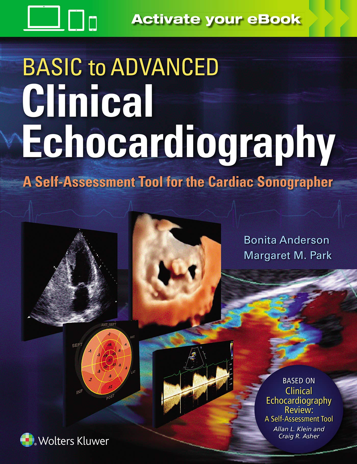Basic to Advanced Clinical Echocardiography: A Self-Assessment Tool for the Cardiac Sonographer-ISBN: 9781975136253