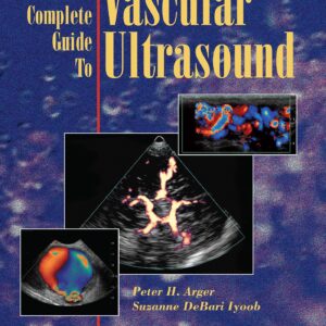 The Complete Guide to Vascular Ultrasound-ISBN: 9780781753463