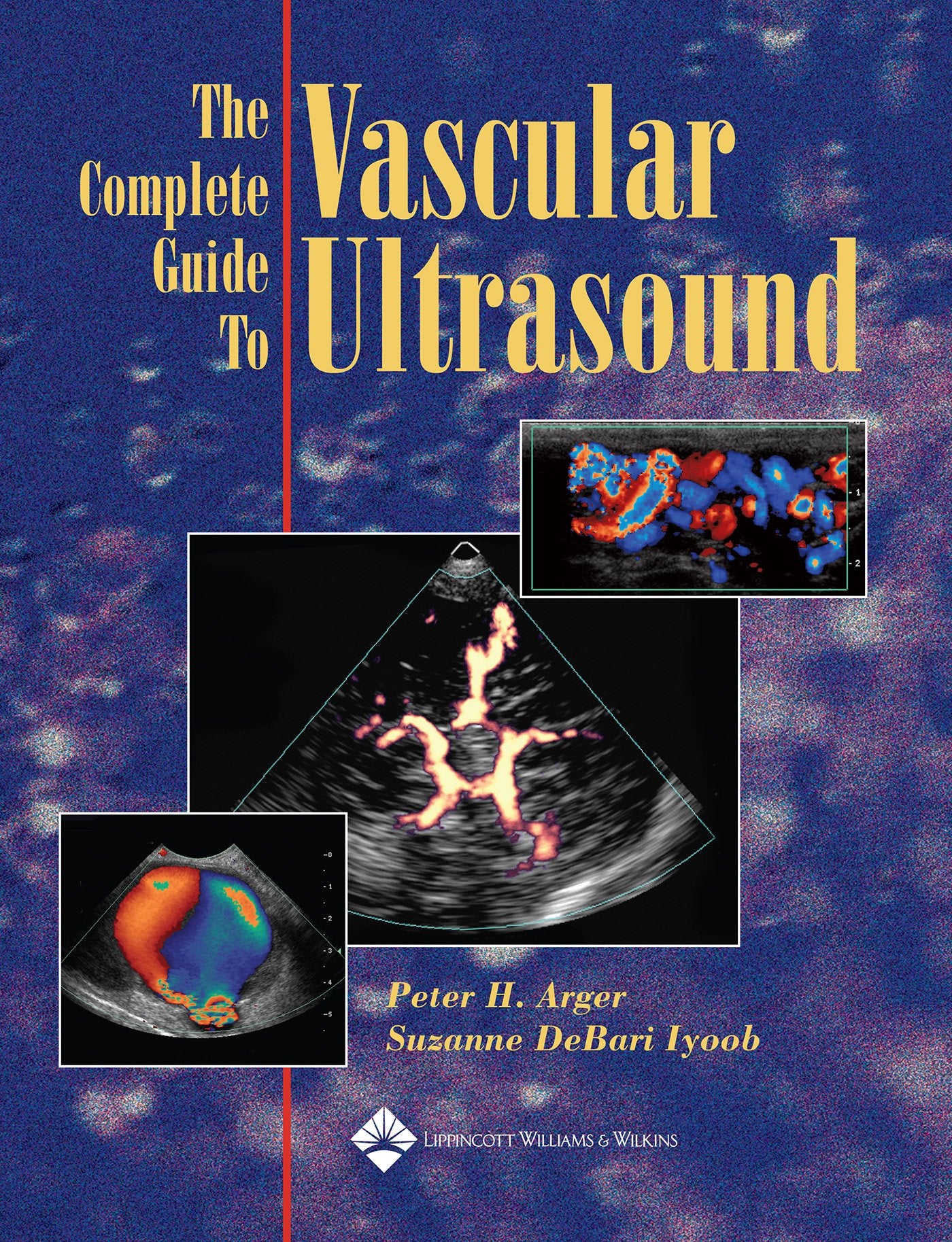 The Complete Guide to Vascular Ultrasound-ISBN: 9780781753463