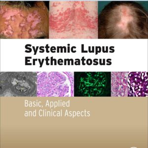 Systemic Lupus Erythematosus: Basic