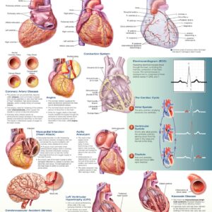 Cardiovascular Disease Anatomical Chart-ISBN: 9781496369796