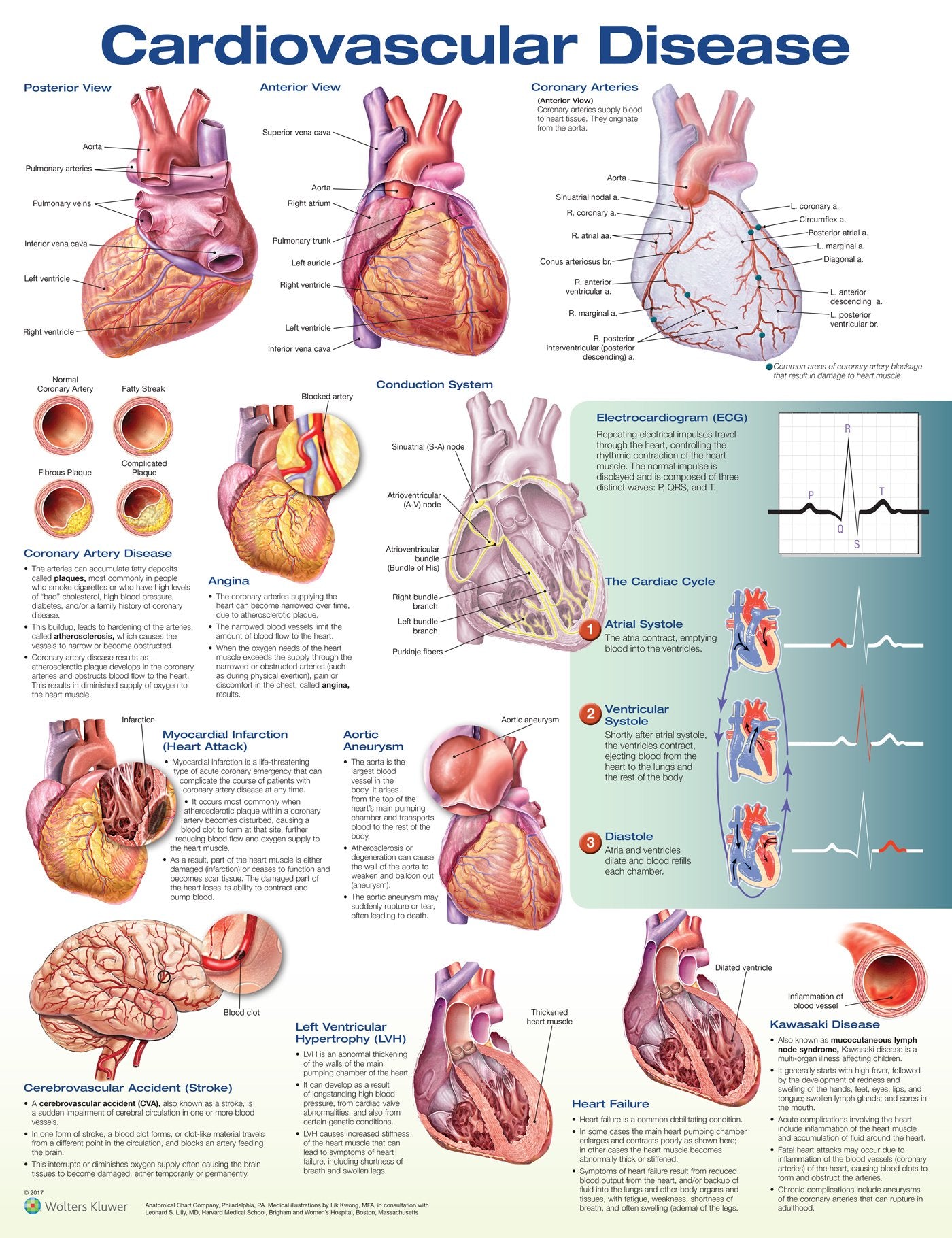Cardiovascular Disease Anatomical Chart-ISBN: 9781496369796